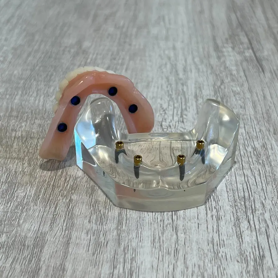 snap-in implant dentures in Villanova